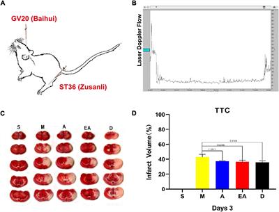 Acupuncture at GV20 and ST36 Improves the Recovery of Behavioral Activity in Rats Subjected to Cerebral Ischemia/Reperfusion Injury